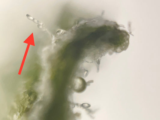 【スマホで顕微鏡観察！】菊芋の葉っぱが白くなった・・・その正体は！？原因と対処法
